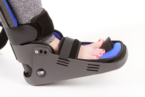 The Equinus Brace®- One hour per day treatment for Plantar Fasciitis and related foot pain