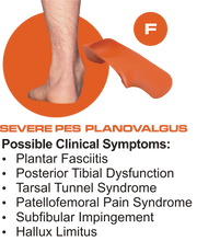 Load image into Gallery viewer, QUADRASTEP® F Quad Foot Orthotics